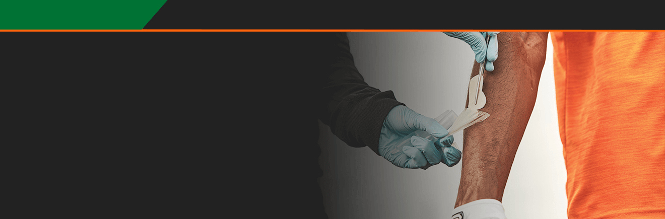 SSE #161: Metodología de pruebas de sudoración en el campo: Retos y mejores prácticas